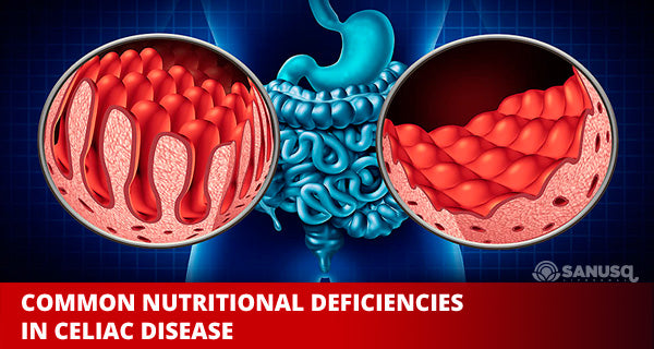 Nutritional deficiencies in celiac disease